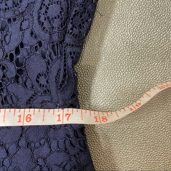 H&M Lace Dress - Picture 9 of 11